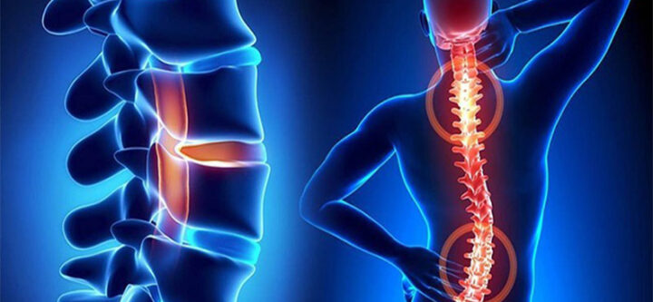 spine